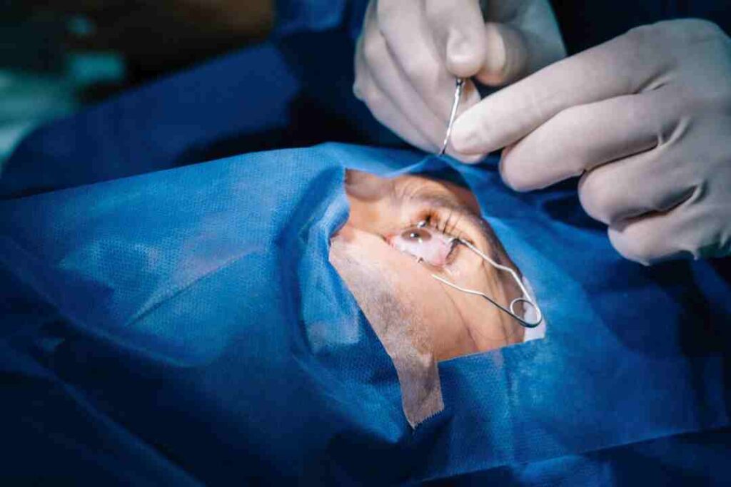 LASIK and Other Eye Procedures